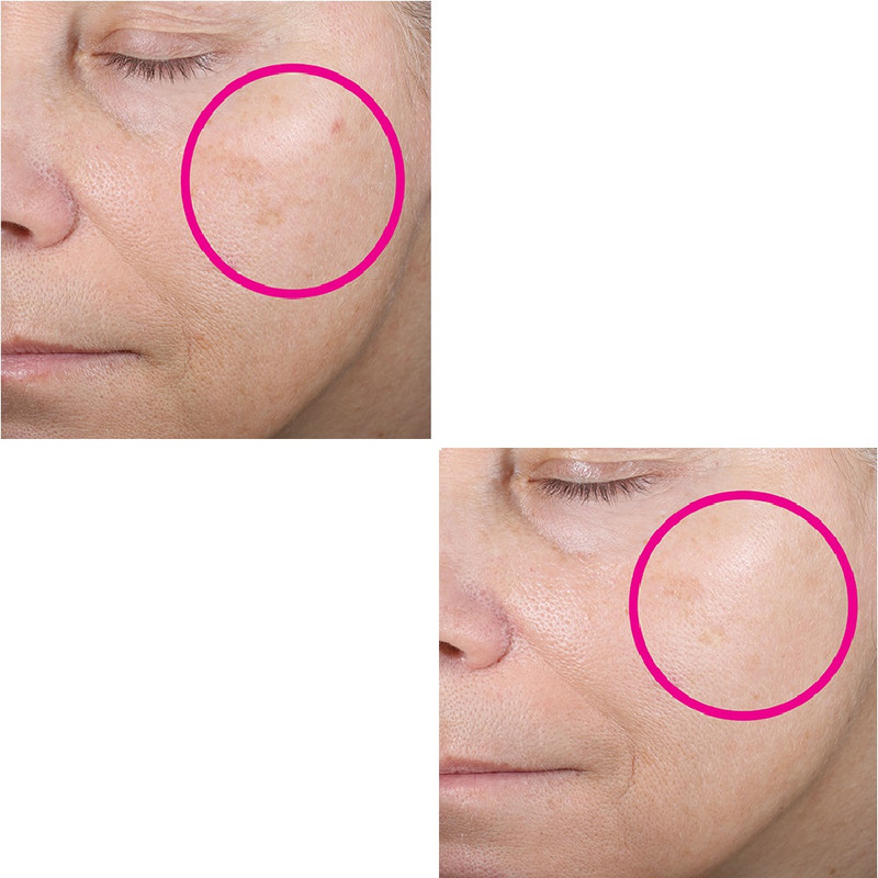 سرم ضد چروک دی اوردینری Retinol 0.5% in Squalane حجم 30 میلی لیتر