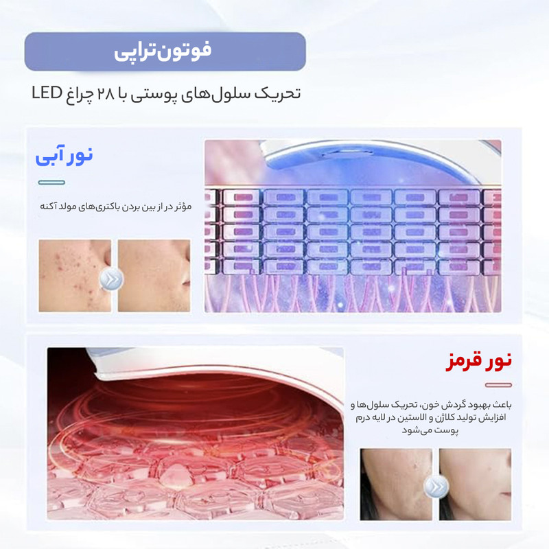 دستگاه جوانسازی آنلن مدل 2013