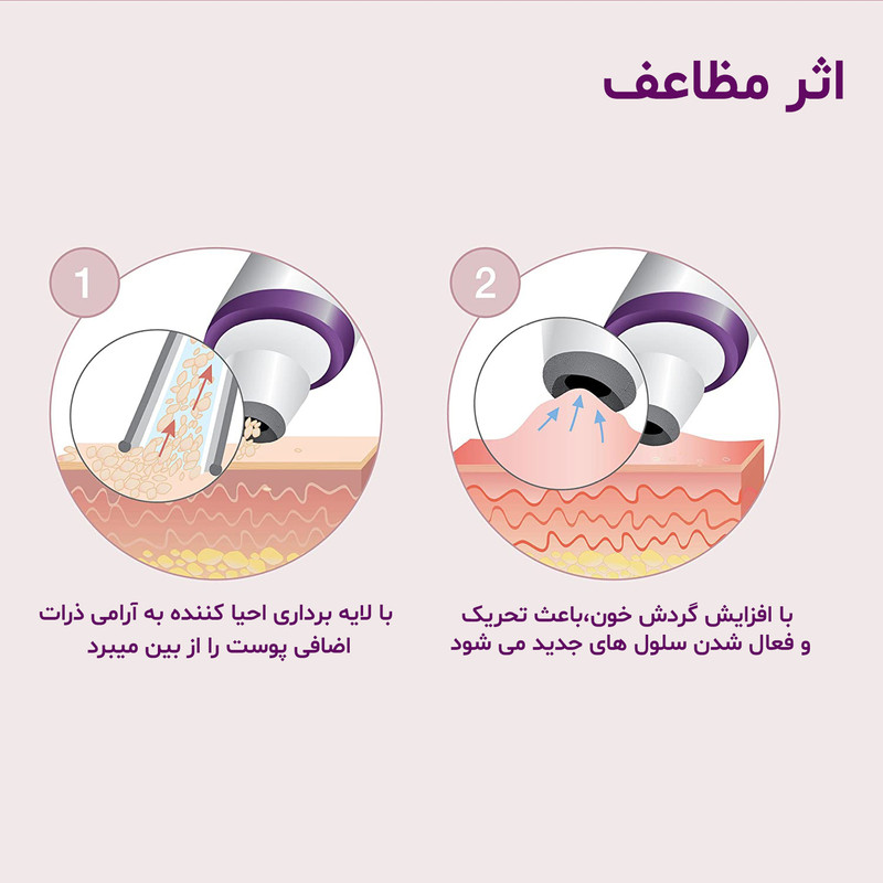 میکرودرم بیورر مدل FC 76